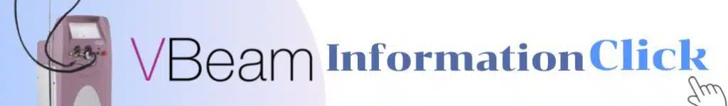 vbeam information