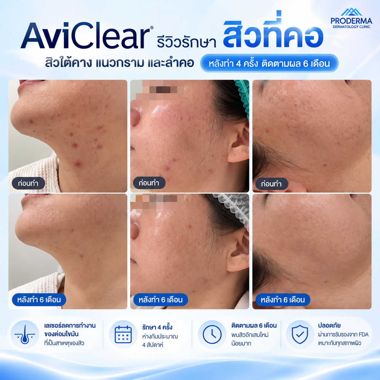 aviclear neck review