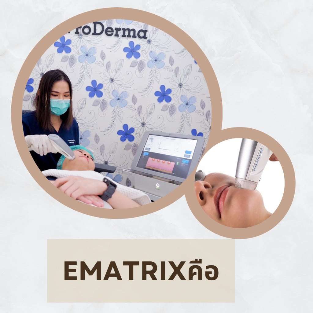 Ematrix รีวิว