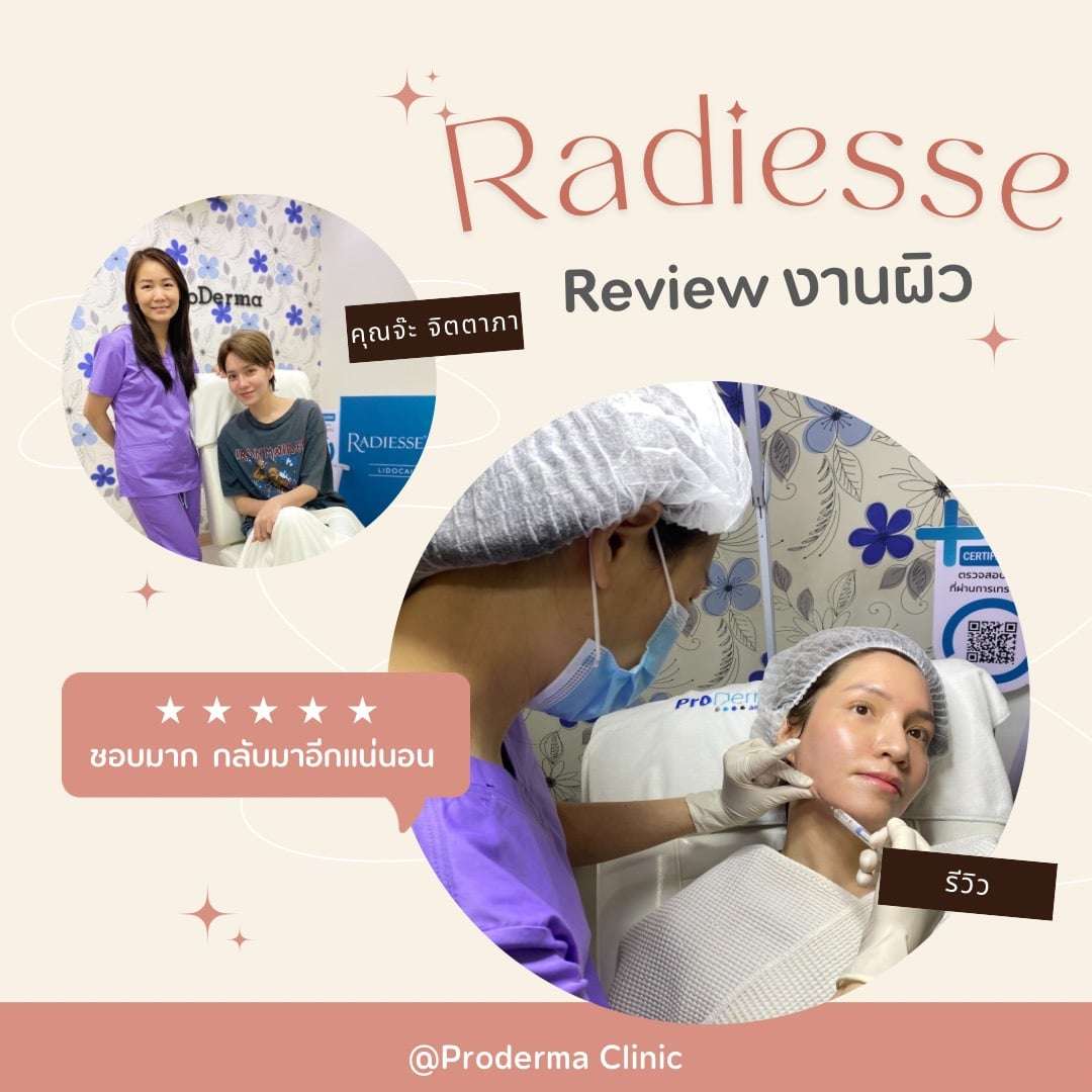 Radiesse Before–After รีวิวทันทีถึง 1 เดือน