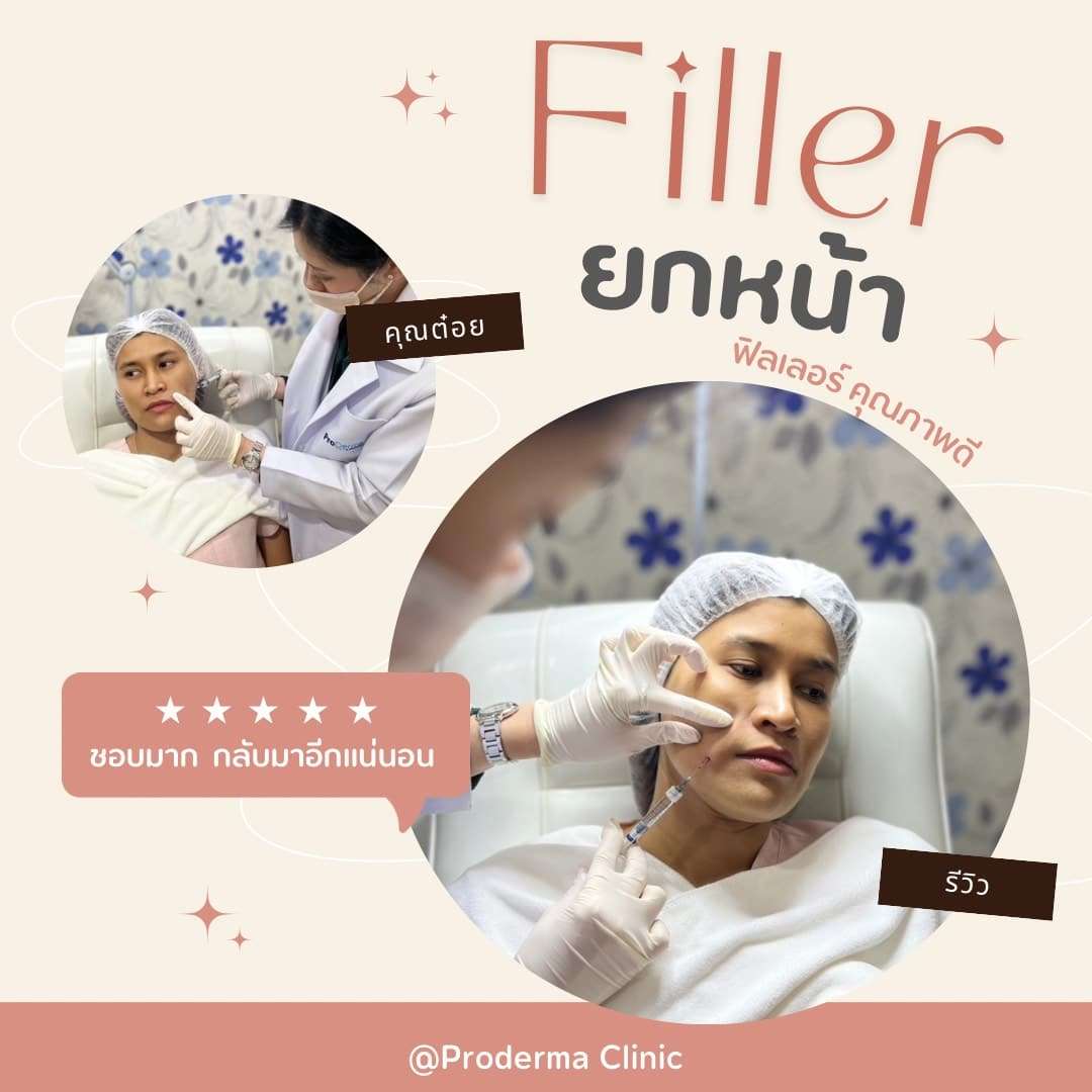Filler Lift ยกหน้าอย่างไร? รีวิวก่อน–หลังและข้อควรรู้