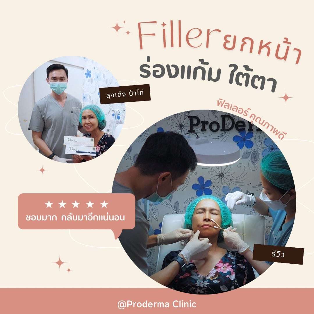 รีวิวฟิลเลอร์ร่องแก้มและใต้ตา วางแผนปรับสมดุลทั้งใบหน้า