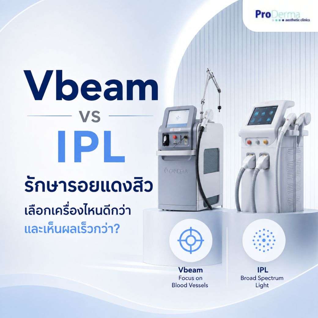 Vbeam vs IPL เปรียบเทียบความต่าง ทำไม Vbeam ถึงรักษารอยแดงได้ดีกว่า?